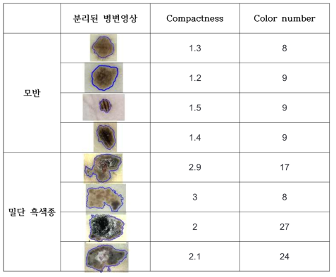 피부암의 Compactness와 Color 종류