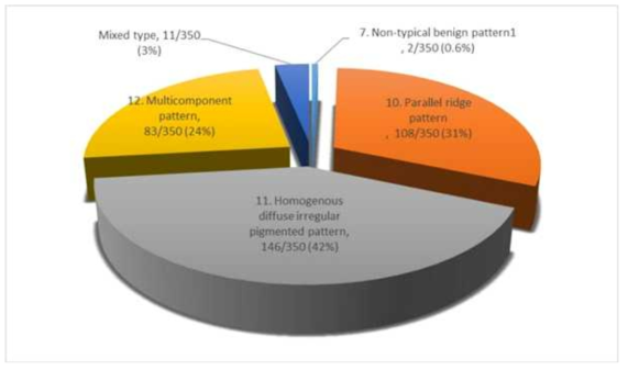손발에 발생한 흑색종으로 판정된 350장의 dermoscopy 영상의 형태별 분포