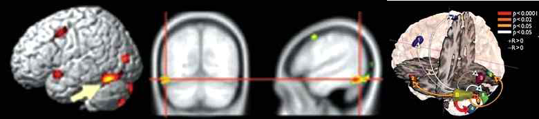 어의 처리 동안의 뇌기능 신경망