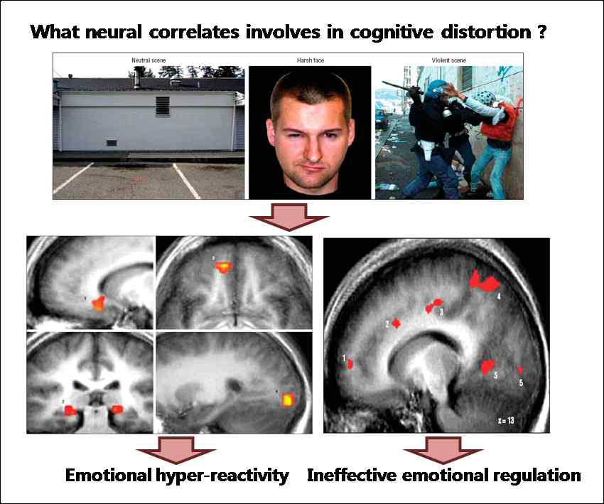 사회불안장애 뇌영상 연구의 예 (Goldin et al., 2009)