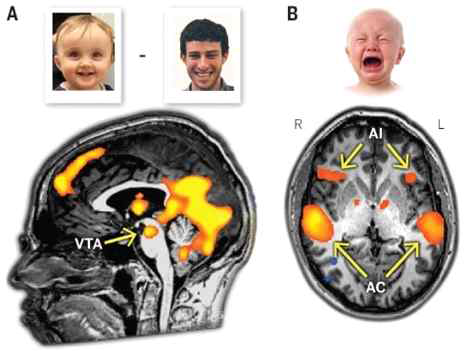 아이 기분에 대한 아버지의 뇌반응을 fMRI로 매핑한 결과 (Rilling, 2013)