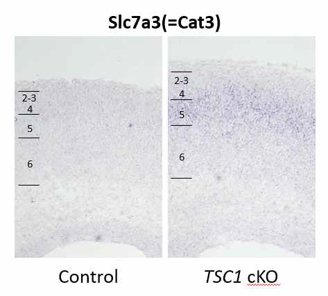 RNA in situ hybridization of SLC7A