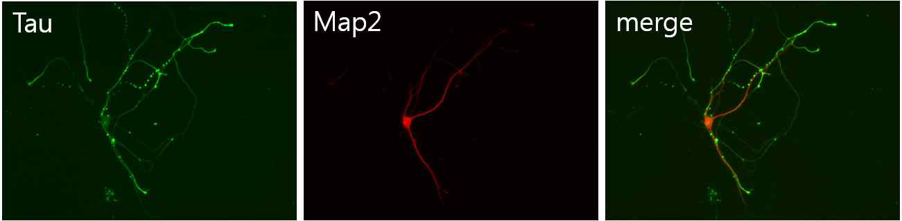 In vitro culture of hippocampal neuron