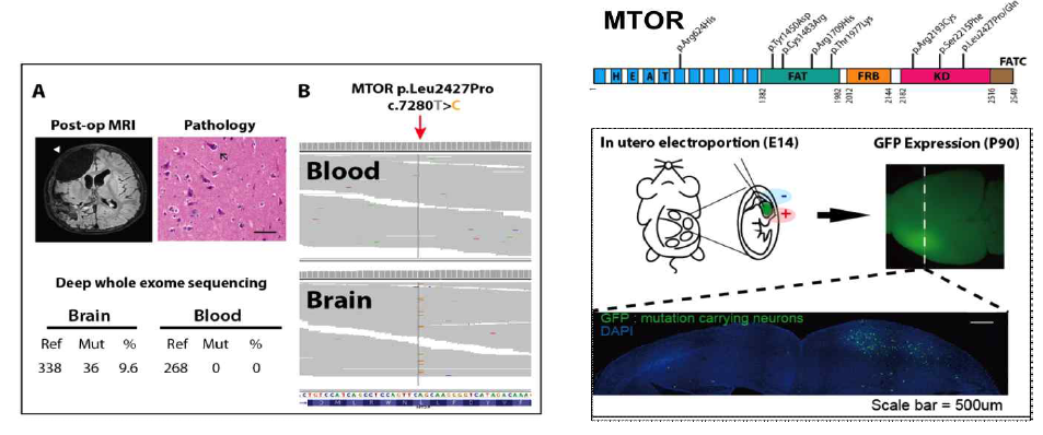 난치성 뇌전증 환자에서의 뇌 특이적 체성 유전변이 발굴 및 동물 모델 증명 데이터 (Lim et al Nature Medicine, 2015)