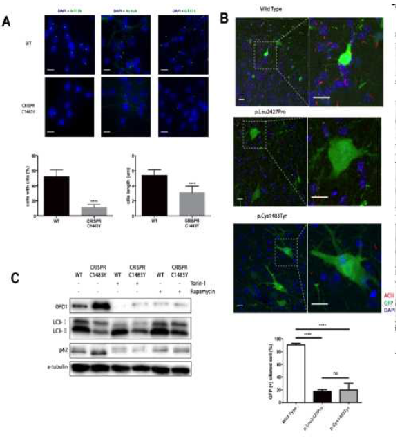 난치성 뇌전증 유발 mTOR 뇌 체성 유전 변이에 의해 autophagy-mediated ciliogenesis가 억제됨을 보여주는 in vivo 데이터 (Park et al. in preparation)