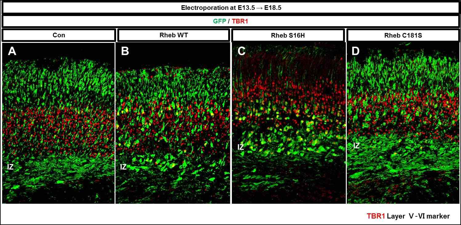 E13.5 시기에 Rheb 및 돌연변이 유전자를 발현 후 E18.5에 확인