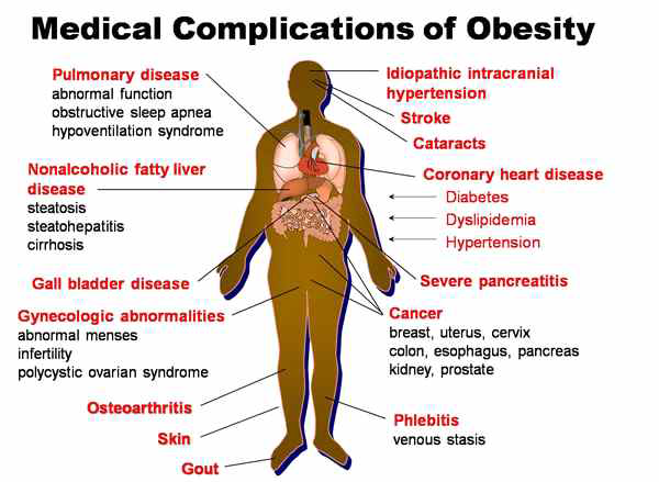 비만증이 야기하는 진신 질환들