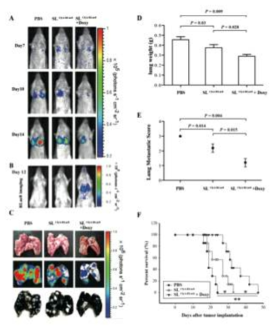 Lung metastasis 마우스 모델에서의 박테리아테라피 검증