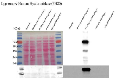 Hyaluronidase 효소 발현 박테리아 구축 및 발현확인