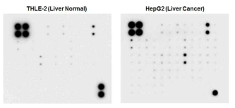 Microarray를 이용한 정상 간세포와 간암세포 간의 단백질 신호 비교 분석