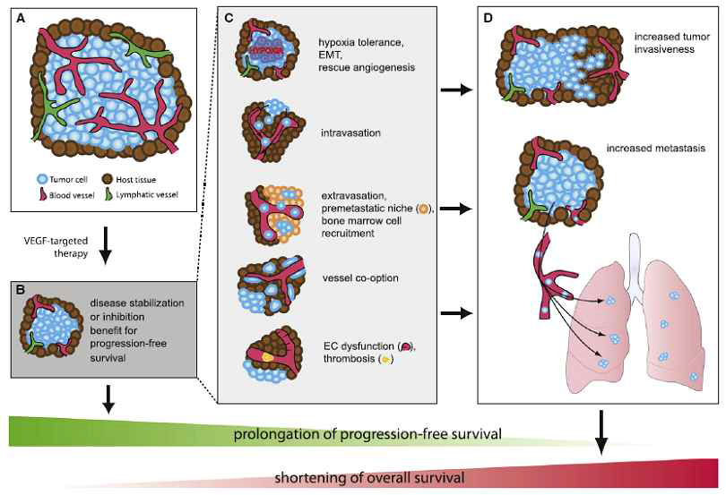 The model of cancer metastasis evoked by angiogenesis inhibitor