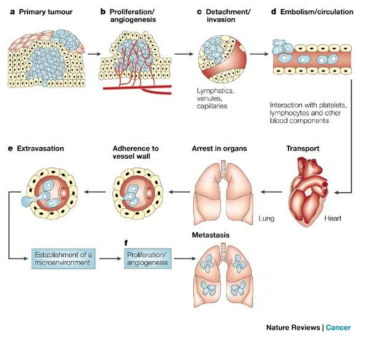 The main steps in the formation of a metastasis