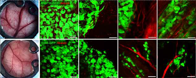 B16F10-GFP melanoma 및 H460-GFP NSCLC 종양세포의 부위별 morphology 및 혈관 주변부 정렬을 영상화한 결과