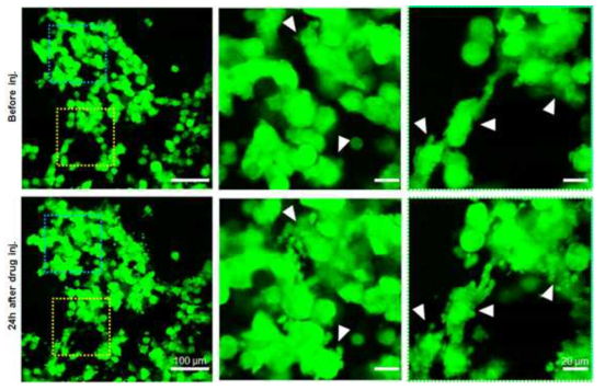 항암제 처리에 따른 암세포의 apoptosis 관찰 결과