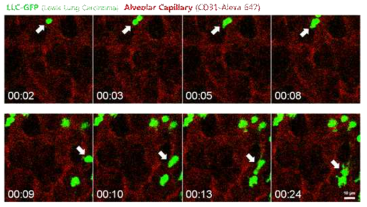 실시간 생체내 폐암세포의 폐혈관 정착 영상