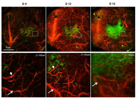 GL261-GFP 뇌종양 동물모델의 주변 혈관의 변화를 장기 영상화