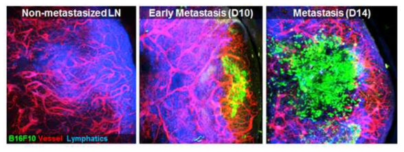 B16F10 melanoma 세포가 전이된 림프절의 영상화 결과