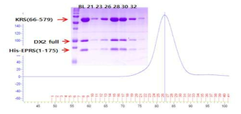 AIMP2-DX2 full,His-EPRS(1-175), LysRS(66-579)의 triple complex의 gel filtration과 SDS_PAGE 결과