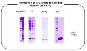 GlyRS anticodon binding domain의 정제