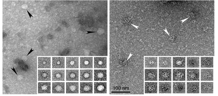 Negative staining of GlyRS associated exosome, showing general appearance (left) and mmuno-EM negative stained exosomes (right)