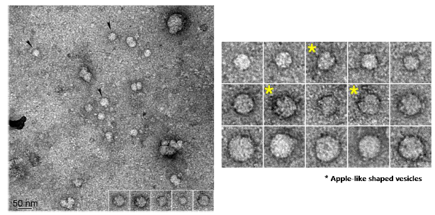 General appearances of LysRS associated exosome (left) and its apple-like shaped exosome (right, yellow asterisks)