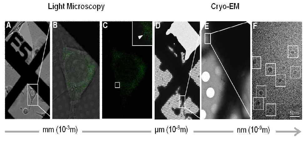 Correlative microscopy를 통한 형광이미징의 구조적 규명