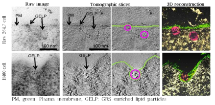 Immuno-EM과 Electron tomography를 통한 GlyRS-enriched particle의 endocytosis과정 규명