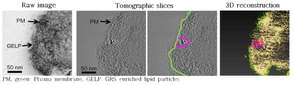 Immuno-EM과 Electron tomography를 통한 GlyRS-enriched particle의 exocytosis과정 규명