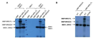 MRS의 phosphorylation. (A) MEK1, ERK1, ERK2에 의한 MRS full-length와 GST-fold 도메인의 인산화 (B) MRS wild type과 S209A mutant의 ERK2에 의한 인산화