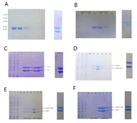 MRS GST domain 과 AIMP3 단백질의 복합체의 co-purification 및 최종 단백질 SDS PAGE. A. MRS207 과 AIMP3(1 to 169) T42MI70MK96M mutant 복합체, B. MRS207 과 AIMP3 S87D mutant 복합체, C. MRS224 과 AIMP3 C147S 복합체, D. MRS224 과 AIMP3 S87D mutant 복합체, E. MRS224 S209D mutant와 AIMP3 C147S mutant 복합체, F. MRS224 S209E mutant와 AIMP3 C147S mutant 복합체. T : Total, S : Soluble, P : Pass, SM : Protein Size marker, W : Washing fraction, E : Elution fraction