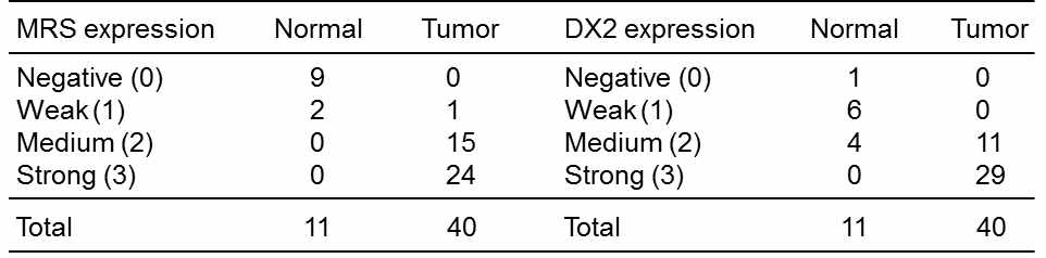 정상 췌장조직과 췌장암 환자 조직에서 MRS 및 AIMP2-DX2 의 staining scoring