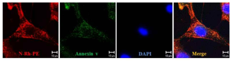 N-Rh-PE를 이용한 중간엽줄기세포 유래 미세소포체와 분비단백체에서 동정된 단백질의 형광 염색