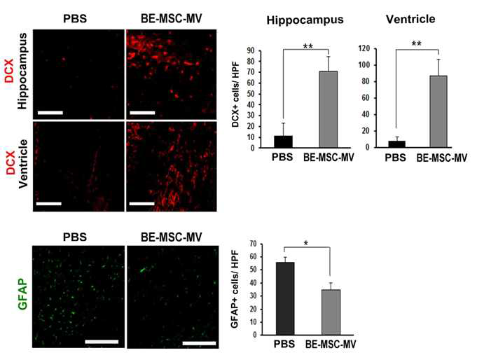 미세소포체 주입 후 내재성 신경전구세포 가동과 염증 완화