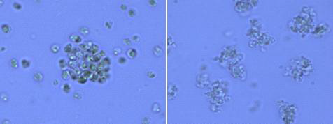 [Bmim][CF3SO3]와 Nannochloropsis oceanica (물함량 65%)를 반응 시켰을 때 현미경 사진