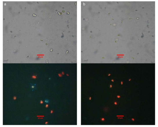 DAPI 염색을 통해서 박테리아의 유무 확인 (a) 트리아이오다이드 처리 전 (b) 트리아이오다이드 처리 후