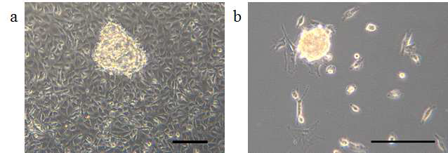 PBAE (C32-122) 전달 시스템을 통해 역분화가 유도된 세포의 형태가 달라진 것을 확인,a. 11 days post-transfection, b. 17 days post-transfection. scale bar = 200 μm