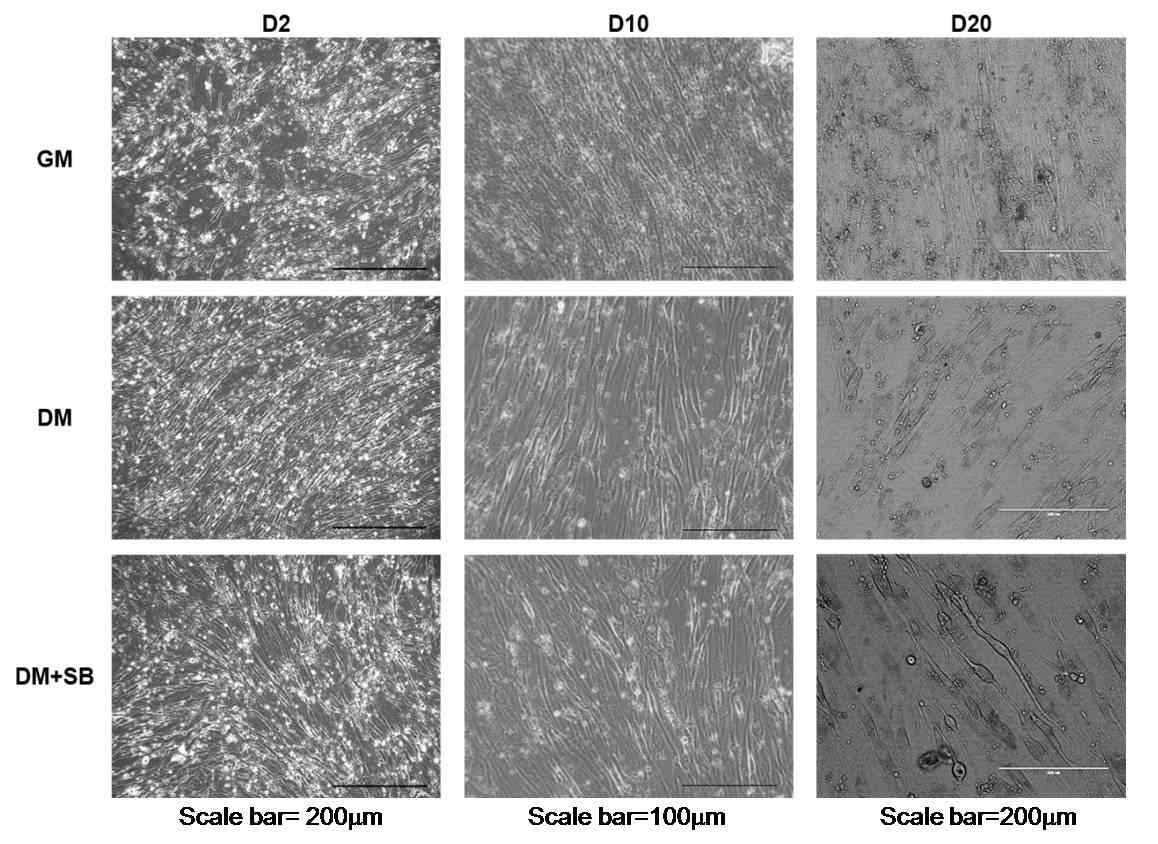 저분자 물질이 도입된 근골격계 분화 유도 배지에 따른 분화