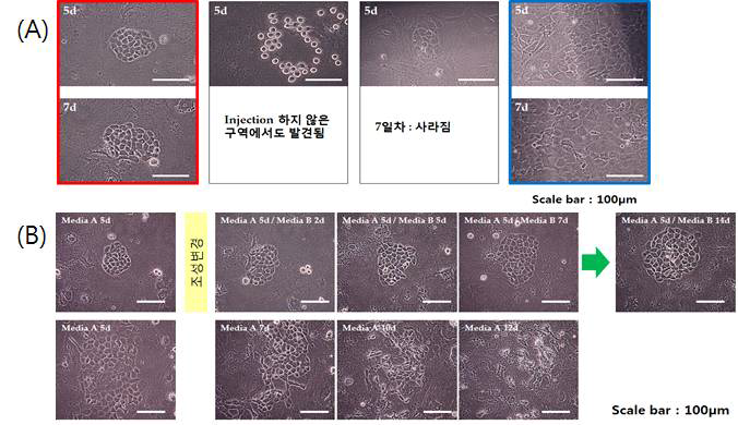 실험 조건 개선을 통한 세포 형태변화 효율 향상 및 결과. 개선된 실험 조건에서 나타난 형태 변화 세포의 확인(A)과 배양조건에 따른 세포상태의 변화 관찰(B)