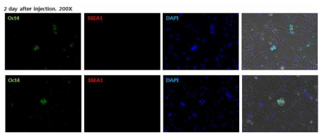 유전자 주입 후 초기에 만능성 유전자 발현을 조사