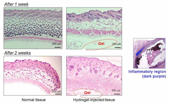 하이드로젤 주사 2주후에 H&E 염색한 Balb/c mouse skin 조직 (좌) 정상조직 (중) 하이드로젤 주사된 조직 (우) 염증유발된 조직