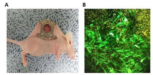 마우스에 dorsal window chamber를 확립한 모습(A)과 그 안에 이식된 GFP를 발현하는 암세포주의 성장을 이광자 현미경으로 촬영한 사진 (B)