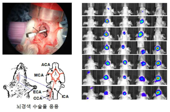 암세포 뇌전이 모델을 나타낸 수술적 방법(왼쪽)과 유방암 뇌전이를 감지하는 생체광학영상 (오른쪽)