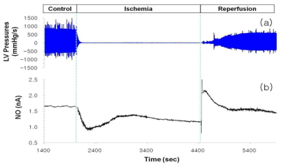 심근허혈-재관류시 (a) 좌심실압과 (b) NO 변화량에 대한 대표적인 실시간 모니터링 결과