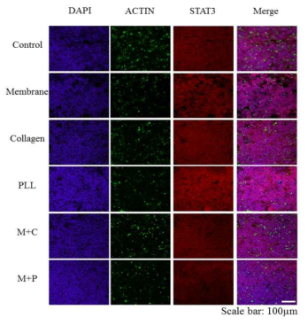 Immunofluorescence staining 결과. cytoskeleton 염색을 이용하여 cell adhesion과 morphology를 확인하였고, anti-apoptosis marker의 하나인 STAT 3를 이용하여 cell prolifration에 문제가 없음을 확인하였음