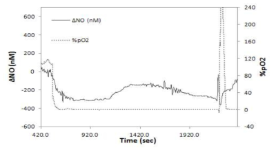 NO/O2 센서를 이용하여 심근 내 허혈 유발에 따른 산화 질소와 산소의 변화에 대한 실시간 측정결과