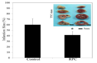 RPC 효과에 대한 TTC 염색 결과. RPC에 의해 심근경색 크기가 감소한 것을 확인