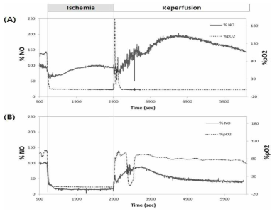 NO/O2 센서를 이용하여 심근 내 허혈 유발에 따른 산화 질소와 산소의 변화에 대한 실시간 측정결과 (A) 대조군, (B) PGE1 처리군