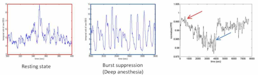 마취 뇌파 데이터에 Power permutation entropy를 적용한 결과. 깨어있는 상태에서는 뇌파의 세기가 상대적으로 복잡한 패턴을 나타내고 코마상태에 가까운 깊은 마취에서는 상대적으로 단순한 패턴을 나타내기 때문에 두 상태 사이에 PPE값이 뚜렷한 차이가 나타난다