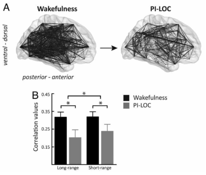 Schroter et al. J Neurosci 2012