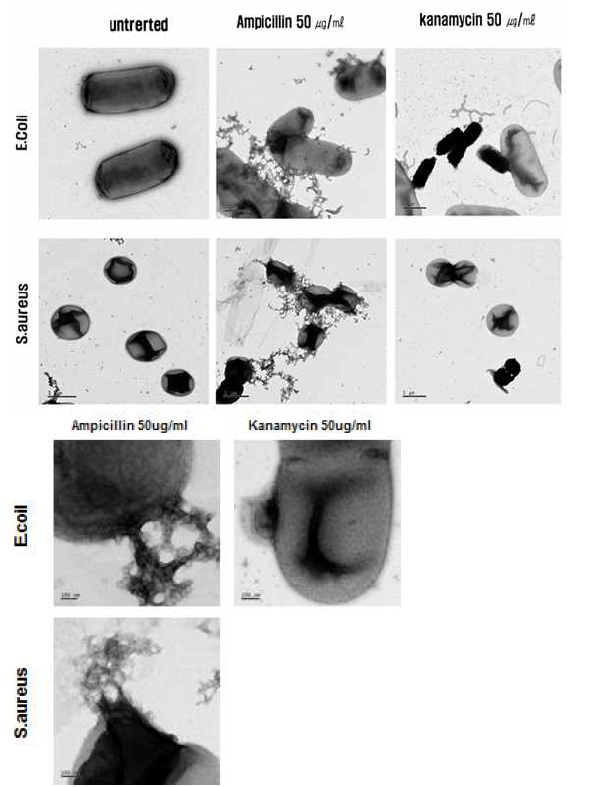 대장균 (E.coil-actcc25922)과 황색포도상균 (S.aureus-atcc29213)에 항생제 각각 처리 후 TEM 이미지 분석